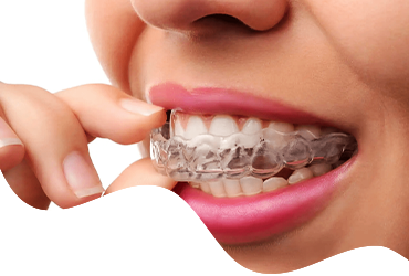 custom-mouth-guards-sports-chennai-thangams-dental-clinic