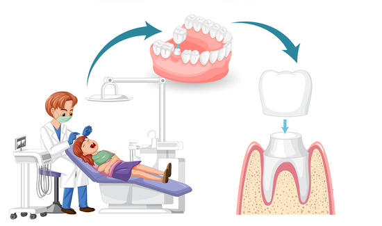 best-prosthodontics-in-chennai-at-thangams-dental-clinic