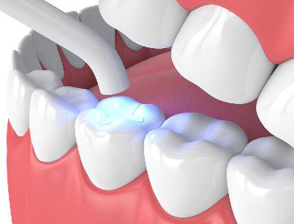 best-dental-treatment-in-chennai